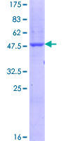 SCN1B Protein - 12.5% SDS-PAGE of human SCN1B stained with Coomassie Blue