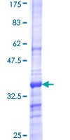 SCN2A / Nav1.2 Protein - 12.5% SDS-PAGE Stained with Coomassie Blue.