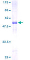 SCN2B Protein - 12.5% SDS-PAGE of human SCN2B stained with Coomassie Blue