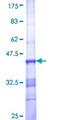 SCN3A / Nav1.3 Protein - 12.5% SDS-PAGE Stained with Coomassie Blue.