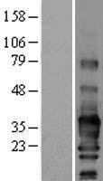 SCN3B Protein - Western validation with an anti-DDK antibody * L: Control HEK293 lysate R: Over-expression lysate