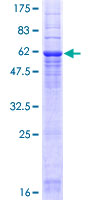 SCN4 / G6PC3 Protein - 12.5% SDS-PAGE of human G6PC3 stained with Coomassie Blue