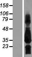SCN4B Protein - Western validation with an anti-DDK antibody * L: Control HEK293 lysate R: Over-expression lysate