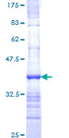 SCN8A / Nav1.6 Protein - 12.5% SDS-PAGE Stained with Coomassie Blue.