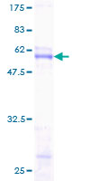SCNM1 Protein - 12.5% SDS-PAGE of human SCNM1 stained with Coomassie Blue