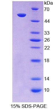 SCNN1A / ENaC Alpha Protein - Recombinant  Amiloride Sensitive Sodium Channel Subunit Alpha By SDS-PAGE