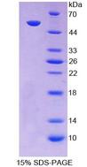 SCNN1A / ENaC Alpha Protein - Recombinant  Amiloride Sensitive Sodium Channel Subunit Alpha By SDS-PAGE