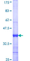 SCNN1D Protein - 12.5% SDS-PAGE Stained with Coomassie Blue.