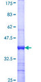 SCNN1D Protein - 12.5% SDS-PAGE Stained with Coomassie Blue.