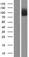 SCNN1G / ENaC Gamma Protein - Western validation with an anti-DDK antibody * L: Control HEK293 lysate R: Over-expression lysate