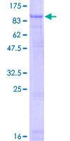 SCNN1G / ENaC Gamma Protein - 12.5% SDS-PAGE of human SCNN1G stained with Coomassie Blue