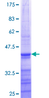SCNN1G / ENaC Gamma Protein - 12.5% SDS-PAGE Stained with Coomassie Blue.