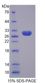 SCNN1G / ENaC Gamma Protein - Recombinant Amiloride Sensitive Sodium Channel Subunit Gamma By SDS-PAGE