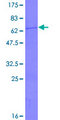 SCO1 Protein - 12.5% SDS-PAGE of human SCO1 stained with Coomassie Blue