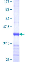 SCO1 Protein - 12.5% SDS-PAGE Stained with Coomassie Blue.