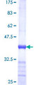 SCO1 Protein - 12.5% SDS-PAGE Stained with Coomassie Blue.
