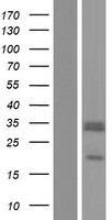 SCO2 Protein - Western validation with an anti-DDK antibody * L: Control HEK293 lysate R: Over-expression lysate