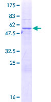 SCO2 Protein - 12.5% SDS-PAGE of human SCO2 stained with Coomassie Blue