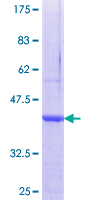 SCO2 Protein - 12.5% SDS-PAGE Stained with Coomassie Blue.