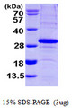 SCO2 Protein