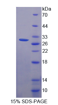 SCO2 Protein - Recombinant  SCO Cytochrome Oxidase Deficient Homolog 2 By SDS-PAGE