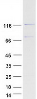 SCP1 / SYCP1 Protein - Purified recombinant protein SYCP1 was analyzed by SDS-PAGE gel and Coomassie Blue Staining