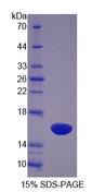 SCP2 / SCPX Protein - Recombinant Sterol Carrier Protein 2 (SCP2) by SDS-PAGE