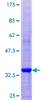 SCRG1 Protein - 12.5% SDS-PAGE of human SCRG1 stained with Coomassie Blue