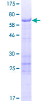 SCRN2 / Ses2 Protein - 12.5% SDS-PAGE of human SCRN2 stained with Coomassie Blue