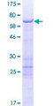 SCRN2 / Ses2 Protein - 12.5% SDS-PAGE of human SCRN2 stained with Coomassie Blue