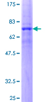 SCTR / SR / Secretin Receptor Protein - 12.5% SDS-PAGE of human SCTR stained with Coomassie Blue