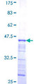 SCTR / SR / Secretin Receptor Protein - 12.5% SDS-PAGE Stained with Coomassie Blue.