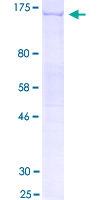 SCUBE1 Protein - 12.5% SDS-PAGE of human SCUBE1 stained with Coomassie Blue