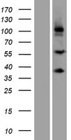 SCUBE3 Protein - Western validation with an anti-DDK antibody * L: Control HEK293 lysate R: Over-expression lysate