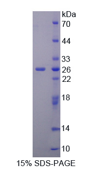 SCUBE3 Protein - Recombinant  Signal Peptide, CUB Domain, EGF Like 3 By SDS-PAGE