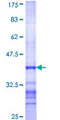 SCYL2 Protein - 12.5% SDS-PAGE Stained with Coomassie Blue.