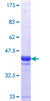 SCYL3 Protein - 12.5% SDS-PAGE Stained with Coomassie Blue.