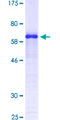 SDC1 / Syndecan 1 / CD138 Protein - 12.5% SDS-PAGE Stained with Coomassie Blue.