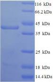 SDC1 / Syndecan 1 / CD138 Protein