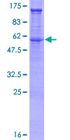 SDC2 / Syndecan 2 Protein - 12.5% SDS-PAGE of human SDC2 stained with Coomassie Blue