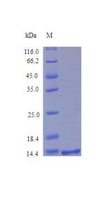 SDC4 / Syndecan 4 Protein