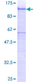 SDC4 / Syndecan 4 Protein - 12.5% SDS-PAGE of human SDC4 stained with Coomassie Blue
