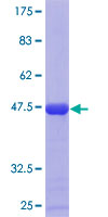 SDC4 / Syndecan 4 Protein - 12.5% SDS-PAGE Stained with Coomassie Blue.