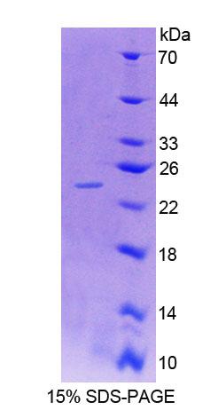SDC4 / Syndecan 4 Protein - Recombinant Syndecan 4 By SDS-PAGE