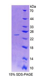 SDC4 / Syndecan 4 Protein - Recombinant Syndecan 4 By SDS-PAGE