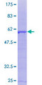 SDCBP / Syntenin Protein - 12.5% SDS-PAGE of human SDCBP stained with Coomassie Blue