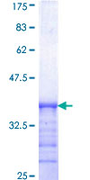 SDCBP / Syntenin Protein - 12.5% SDS-PAGE Stained with Coomassie Blue.
