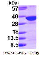 SDCBP / Syntenin Protein