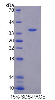 SDCBP / Syntenin Protein - Recombinant  Syntenin 1 By SDS-PAGE