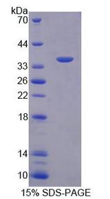 SDCBP / Syntenin Protein - Recombinant  Syntenin 1 By SDS-PAGE